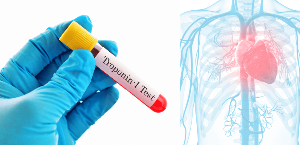 Troponin I Troponin T İnci Laboratoriyaları